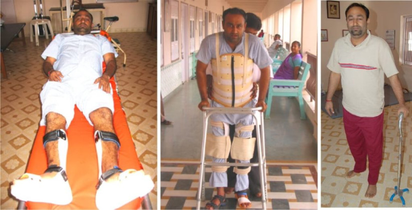 Rohit Chheda - Paraplegic Patient